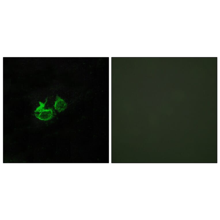 Immunofluorescence - Anti-GHRHR Antibody (G271) - Antibodies.com