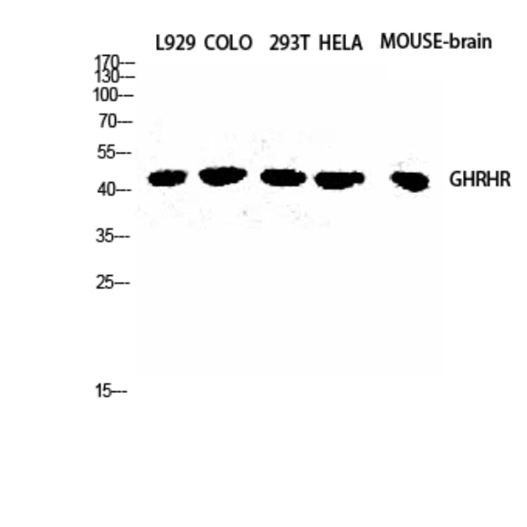 Western Blot - Anti-GHRHR Antibody (G271) - Antibodies.com