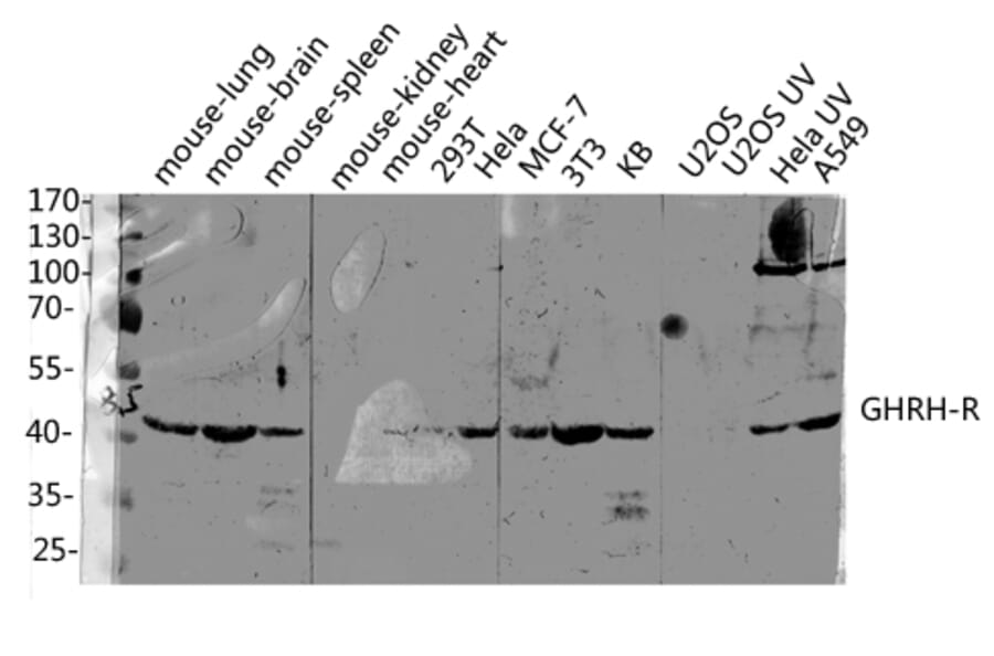 Western Blot - Anti-GHRHR Antibody (G271) - Antibodies.com