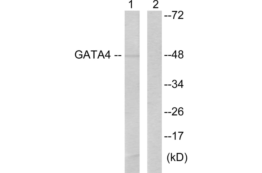 Western Blot - Anti-GATA4 Antibody (B0935) - Antibodies.com
