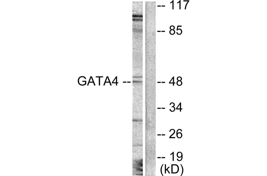 Western Blot - Anti-GATA4 Antibody (B0934) - Antibodies.com