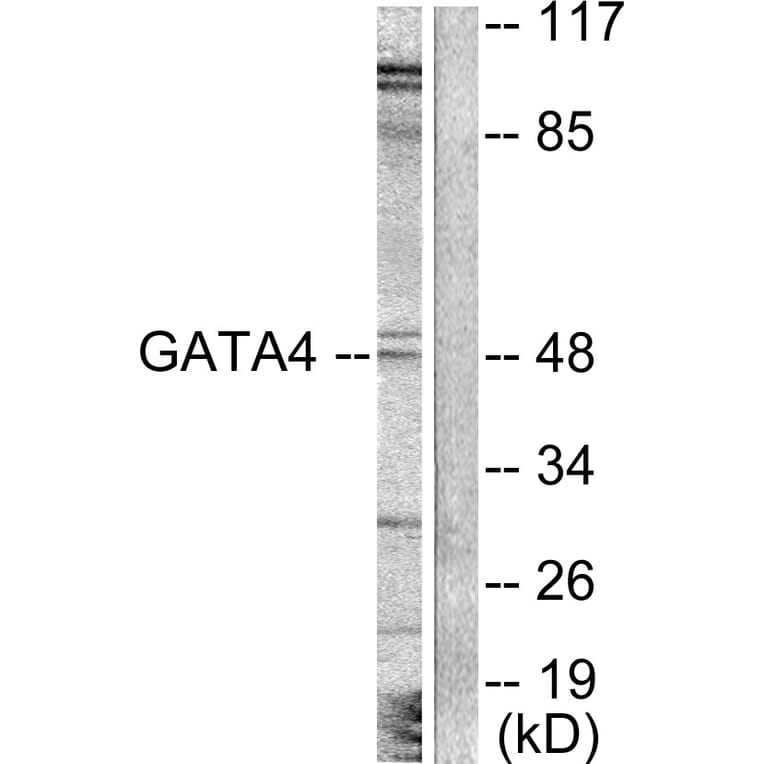 Western Blot - Anti-GATA4 Antibody (B0934) - Antibodies.com