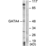Western Blot - Anti-GATA4 Antibody (B0934) - Antibodies.com