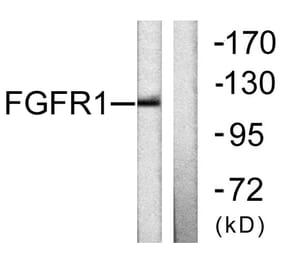 Western Blot - Anti-FGFR1 Antibody (B0481) - Antibodies.com