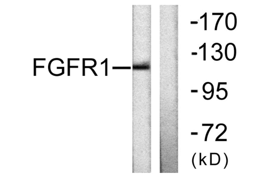 Western Blot - Anti-FGFR1 Antibody (B0481) - Antibodies.com