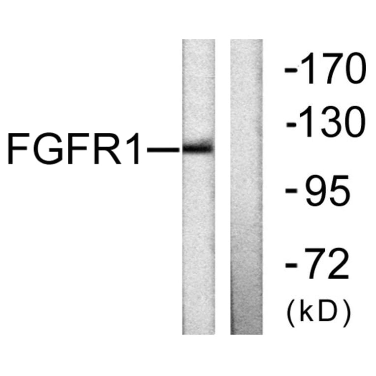 Western Blot - Anti-FGFR1 Antibody (B0481) - Antibodies.com
