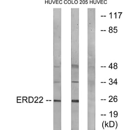 Western Blot - Anti-ERD22 Antibody (C15673) - Antibodies.com