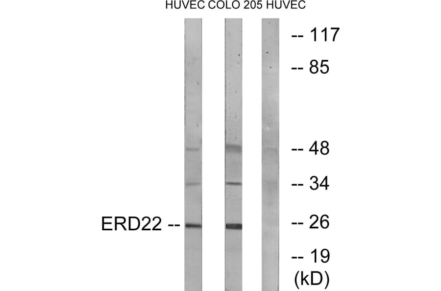 Western Blot - Anti-ERD22 Antibody (C15673) - Antibodies.com