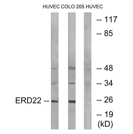 Western Blot - Anti-ERD22 Antibody (C15673) - Antibodies.com