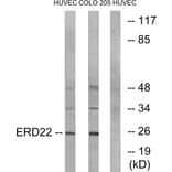 Western Blot - Anti-ERD22 Antibody (C15673) - Antibodies.com