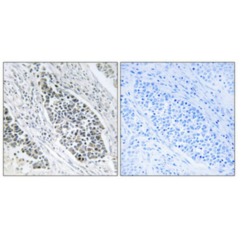 Immunohistochemistry - Anti-ERD22 Antibody (C15673) - Antibodies.com
