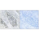 Immunohistochemistry - Anti-ERD22 Antibody (C15673) - Antibodies.com
