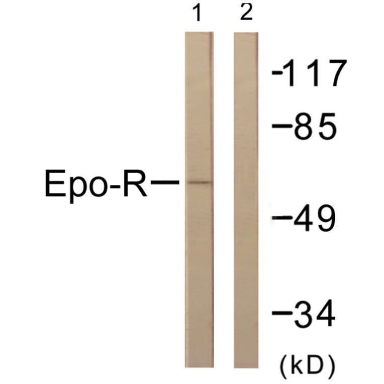 Western Blot - Anti-Epo-R Antibody (B0917) - Antibodies.com