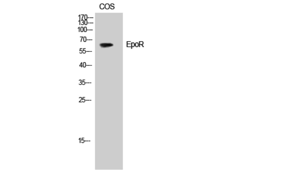 Western Blot - Anti-Epo-R Antibody (B0917) - Antibodies.com