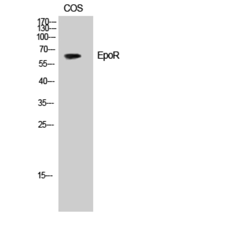 Western Blot - Anti-Epo-R Antibody (B0917) - Antibodies.com