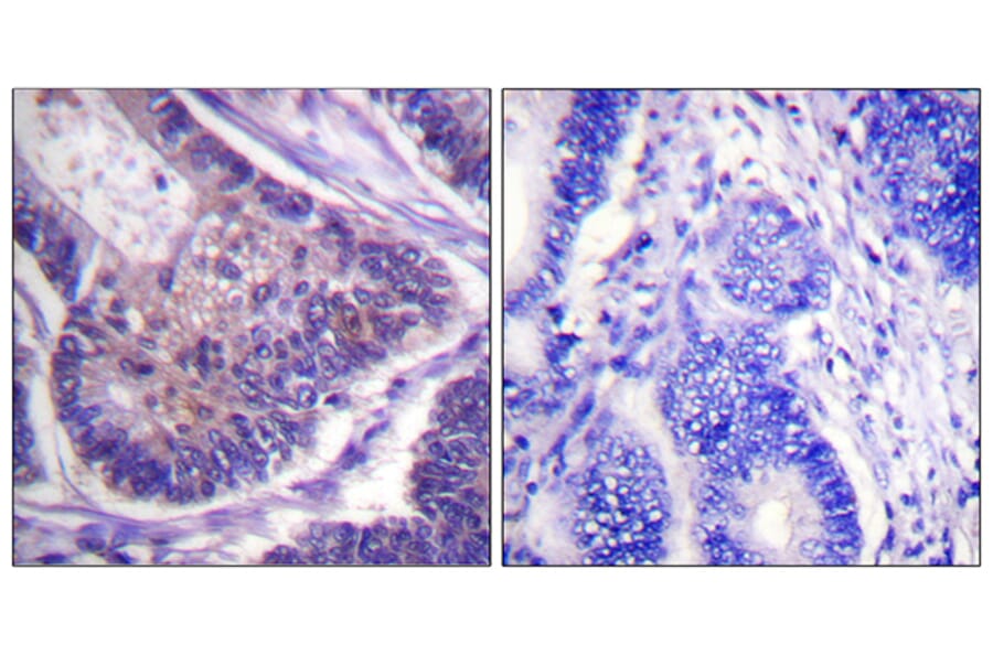 Immunohistochemistry - Anti-eIF4B Antibody (B0641) - Antibodies.com
