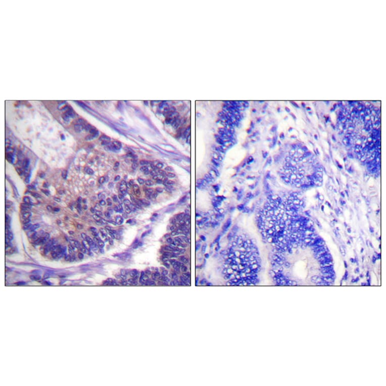 Immunohistochemistry - Anti-eIF4B Antibody (B0641) - Antibodies.com