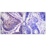 Immunohistochemistry - Anti-eIF4B Antibody (B0641) - Antibodies.com