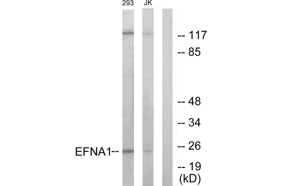 Western Blot - Anti-EFNA1 Antibody (C10440) - Antibodies.com