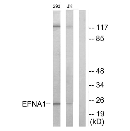 Western Blot - Anti-EFNA1 Antibody (C10440) - Antibodies.com