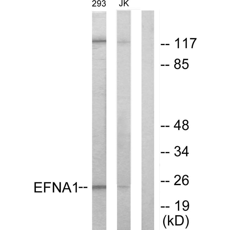 Western Blot - Anti-EFNA1 Antibody (C10440) - Antibodies.com