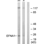 Western Blot - Anti-EFNA1 Antibody (C10440) - Antibodies.com