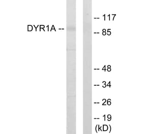 Western Blot - Anti-DYR1A Antibody (C11002) - Antibodies.com