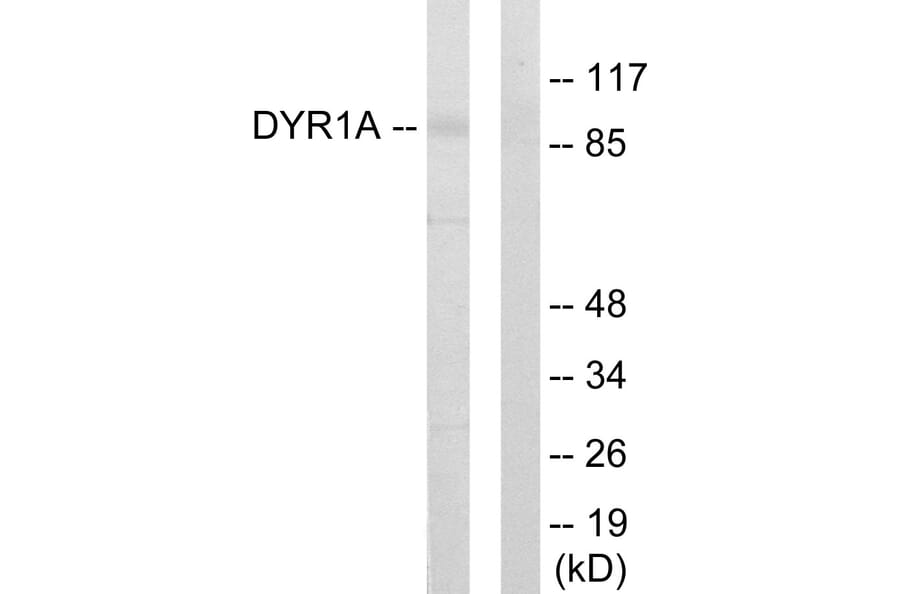 Western Blot - Anti-DYR1A Antibody (C11002) - Antibodies.com