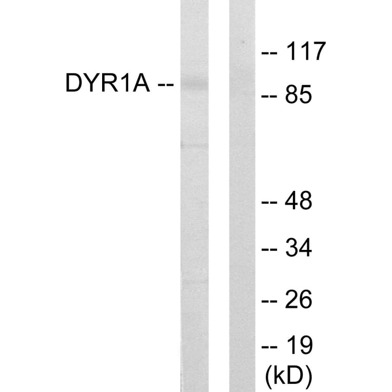 Western Blot - Anti-DYR1A Antibody (C11002) - Antibodies.com