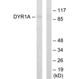 Western Blot - Anti-DYR1A Antibody (C11002) - Antibodies.com