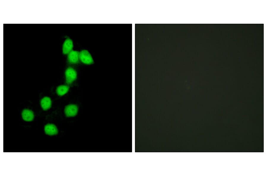 Immunofluorescence - Anti-DYR1A Antibody (C11002) - Antibodies.com