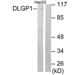 Western Blot - Anti-DLGP1 Antibody (C10034) - Antibodies.com