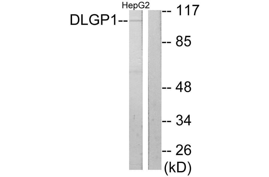 Western Blot - Anti-DLGP1 Antibody (C10034) - Antibodies.com