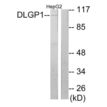 Western Blot - Anti-DLGP1 Antibody (C10034) - Antibodies.com