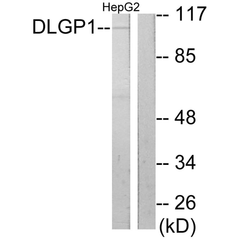 Western Blot - Anti-DLGP1 Antibody (C10034) - Antibodies.com