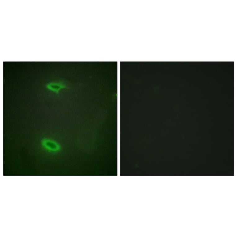 Immunofluorescence - Anti-DLGP1 Antibody (C10034) - Antibodies.com