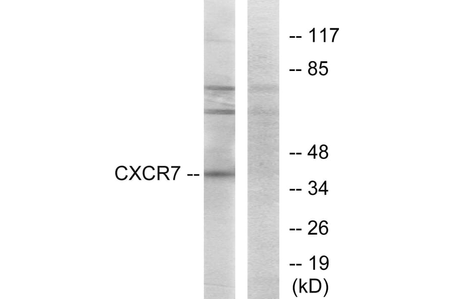 Western Blot - Anti-CXCR7 Antibody (G065) - Antibodies.com