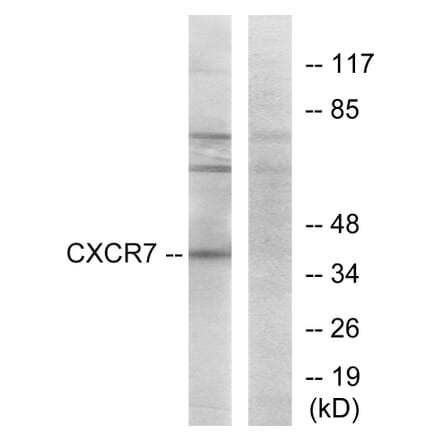 Western Blot - Anti-CXCR7 Antibody (G065) - Antibodies.com