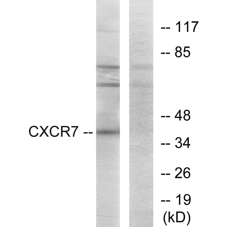 Western Blot - Anti-CXCR7 Antibody (G065) - Antibodies.com