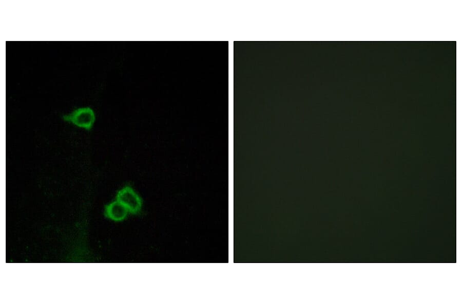 Immunofluorescence - Anti-CXCR7 Antibody (G065) - Antibodies.com