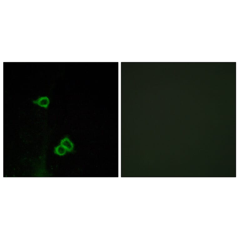 Immunofluorescence - Anti-CXCR7 Antibody (G065) - Antibodies.com