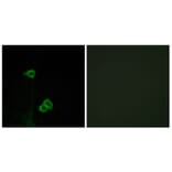 Immunofluorescence - Anti-CXCR7 Antibody (G065) - Antibodies.com