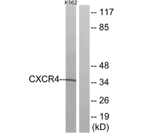 Western Blot - Anti-CXCR4 Antibody (G064) - Antibodies.com
