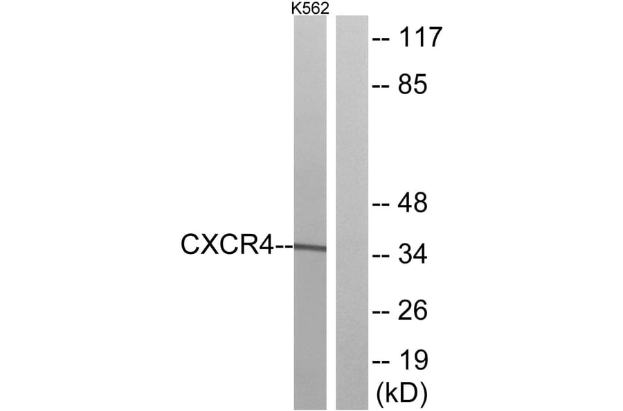 Western Blot - Anti-CXCR4 Antibody (G064) - Antibodies.com