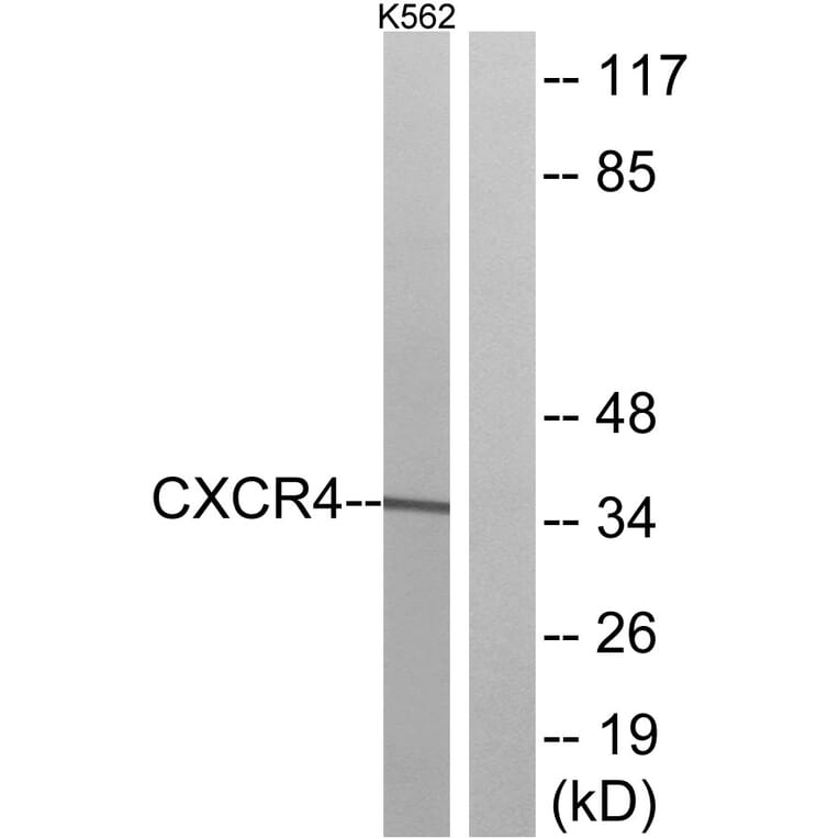 Western Blot - Anti-CXCR4 Antibody (G064) - Antibodies.com