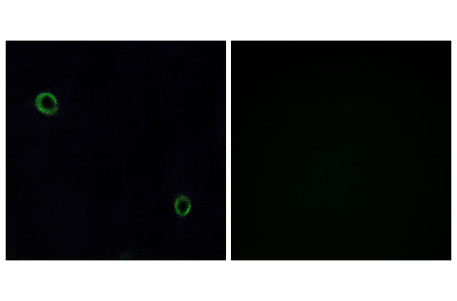 Immunofluorescence - Anti-CXCR4 Antibody (G064) - Antibodies.com