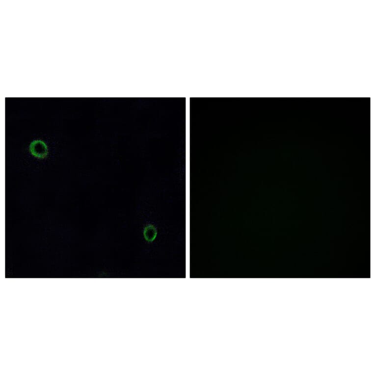 Immunofluorescence - Anti-CXCR4 Antibody (G064) - Antibodies.com
