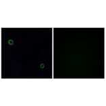 Immunofluorescence - Anti-CXCR4 Antibody (G064) - Antibodies.com