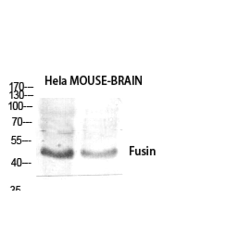 Western Blot - Anti-CXCR4 Antibody (G064) - Antibodies.com