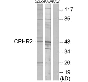 Western Blot - Anti-CRHR2 Antibody (G073) - Antibodies.com